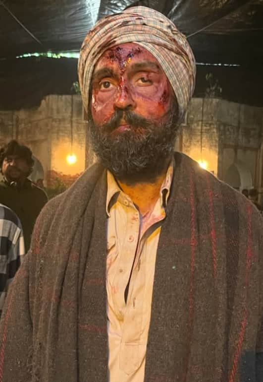 ਦਿਲਜੀਤ ਦੋਸਾਂਝ ਦੀਆਂ ਲਹੂ ਨਾਲ ਲੱਥਪੱਥ ਤਸਵੀਰਾਂ ਵਾਇਰਲ! ਸਦਮੇ 'ਚ ਫੈਨਜ਼...