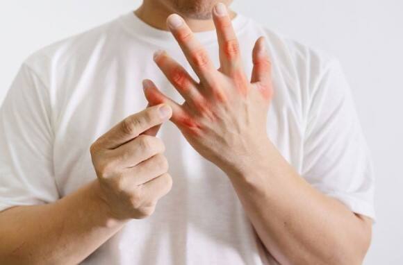 નિષ્ણાંતોના મતે જ્યારે શરીરમાં યુરિક એસિડ વધે છે ત્યારે વિટામિન સી ખૂબ જ ફાયદાકારક છે. તમારે તમારા આહારમાં વિટામિન સી ધરાવતી વસ્તુઓ જેમ કે નારંગી, અનાનસ અને લીંબુનો સમાવેશ કરવો જોઈએ. તેનાથી તમારી રોગપ્રતિકારક શક્તિ પણ વધશે.