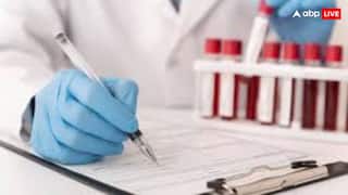 न कैंसर लेगा जान, ना ही रहेगा हार्ट अटैक का खतरा, समय पर करवा लेंगे अगर 5 मेडिकल टेस्ट