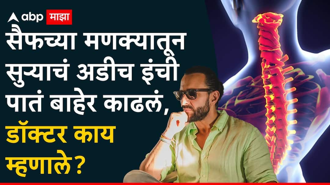Saif ali khan attack in Mumbai: सैफ अली खानच्या मणक्यातून सुऱ्याचं अडीच इंची पातं बाहेर काढलं, थोरॅसिक स्पायनल कॉडला दुखापत, डॉक्टर काय म्हणाले? Saif ali khan health updates 2.5 inch knife blade remove from thoracic spinal cord plastic surgery on neck and hand Saif ali khan attack in Mumbai: सैफ अली खानच्या मणक्यातून सुऱ्याचं अडीच इंची पातं बाहेर काढलं, थोरॅसिक स्पायनल कॉडला दुखापत, डॉक्टर काय म्हणाले?