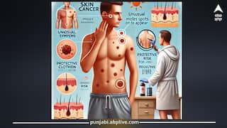 Skin Cancer ਦੇ ਪਹਿਲੇ ਪੜਾਅ 'ਚ ਦਿਖਾਈ ਦਿੰਦੇ ਅਜਿਹੇ ਸੰਕੇਤ, ਮਰਦਾਂ 'ਚ ਜ਼ਿਆਦਾ ਖਤਰਾ, ਬਚਾਅ ਲਈ ਚੁੱਕੋ ਇਹ ਕਦਮ