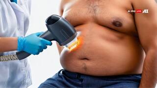 क्या वजन घटाने की सर्जरी कराने वाले ज्यादा करते हैं आत्महत्या? खौफनाक है रिसर्च में मिली जानकारी