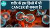 Testicular Cancer का खतरा क्यों हो सकता है? | Cancer | Health Live