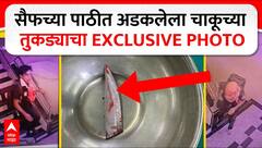 Saif Ali Khan Case Update :सैफच्या पाठीवर ऑपरेशन करुन काढलेला चाकूचा तुकड्याचा फोटो उघड