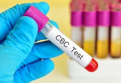 Medical Checkup: શરીરને હેલ્ધી રાખવા માટે જરૂરી છે આ 5 મેડિકલ ટેસ્ટ, નહીં રહે કેન્સર કે હાર્ટ એટેકનો ખતરો...