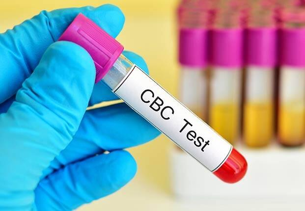 1. कम्प्लीट ब्लड काउंट टेस्ट - इस टेस्ट (कम्प्लीट ब्लड काउंट) को सीबीसी भी कहा जाता है। यह लाल और सफेद रक्त कोशिका के स्तर की निगरानी करके ल्यूकेमिया, एनीमिया या संक्रमण का पता लगाने में मदद करता है। इसे बढ़ने से पहले ही रोका जा सकता है.