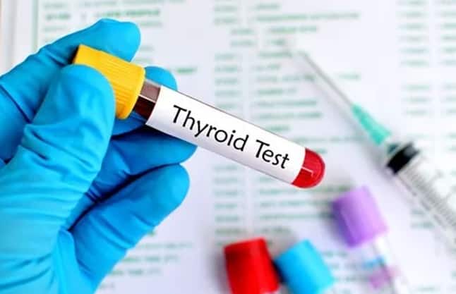 5. थायराइड फंक्शन टेस्ट - यह टेस्ट (थायराइड फंक्शन टेस्ट) शरीर की थायरॉयड ग्रंथि की कार्यप्रणाली की जांच करता है। इसकी मदद से हाइपोथायरायडिज्म और हाइपरथायरायडिज्म जैसी थायरॉइड बीमारियों का पता लगाया जा सकता है।