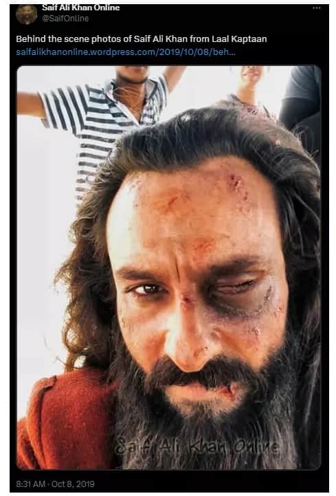 Saif Ali Khan: ক্ষতবিক্ষত মুখ, ঠোঁটে রক্ত, চোখে কালশিটে! সেফের 'আক্রান্ত' ছবি ভাইরাল! আদৌ কি সত্যি?
