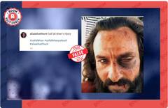 सैफ अली खान के फिल्म का लुक हमले में लगी चोट के दावे से हुआ वायरल