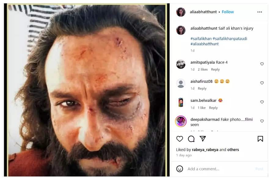 Saif Ali Khan: ক্ষতবিক্ষত মুখ, ঠোঁটে রক্ত, চোখে কালশিটে! সেফের 'আক্রান্ত' ছবি ভাইরাল! আদৌ কি সত্যি?