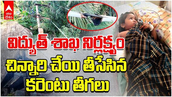 Electric Wires Falling Down Baby Incident | అల్లవరం మండలంలో ప్రాణాలకే ప్రమాదంగా మారిన విద్యుత్ వైర్లు | ABP Desam