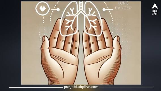 ਫੇਫੜਿਆਂ ਦੇ ਕੈਂਸਰ ਕਾਰਨ ਹੱਥਾਂ 'ਤੇ ਦਿਖਾਈ ਦਿੰਦੇ ਇਹ 2 ਸੰਕੇਤ, ਲੱਛਣ ਪਛਾਣ ਇੰਝ ਕਰੋ ਬਚਾਅ