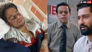 शाहरुख खान संग काम कर चुके एक्टर की किडनी खराब, हफ्ते में दो बार हो रहा डायलिसिस, दोस्त ने मांगी मदद