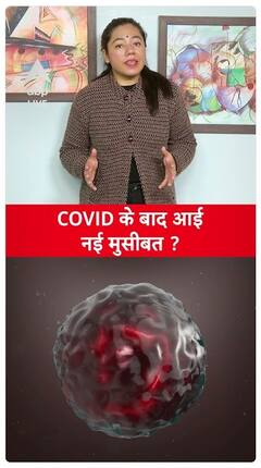 Influenza A: New Challenge Post COVID-19 Surge in Cases Across Multiple Regions