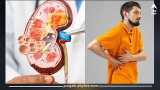 Kidney Failure: ਵਿਟਾਮਿਨ D ਦੀਆਂ ਗੋਲੀਆਂ ਕਰ ਸਕਦੀਆਂ ਕਿਡਨੀ ਫੇਲ੍ਹ! ਡਾਕਟਰਾਂ ਨੇ ਚੇਤਾਵਨੀ ਦਿੱਤੀ, ਇਨ੍ਹਾਂ ਦਾ ਸੇਵਨ ਫਾਇਦੇ ਦੀ ਬਜਾਏ ਇੰਝ ਪਹੁੰਚਾਉਂਦਾ ਨੁਕਸਾਨ...