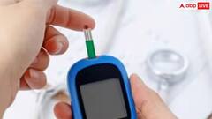 Diabetes Symptoms: લોહીમાં સુગર લેવલ વધવાથી શરીર આપવા લાગે છે આ સંકેત,બદલાવા લાગે છે ત્વચાનો રંગ