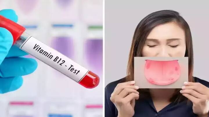 Vitamin B12 symptoms: વિટામિન B12 ની ઉણપના કારણે જોવા મળે છે આ લક્ષણો, જાણો તેના વિશે
