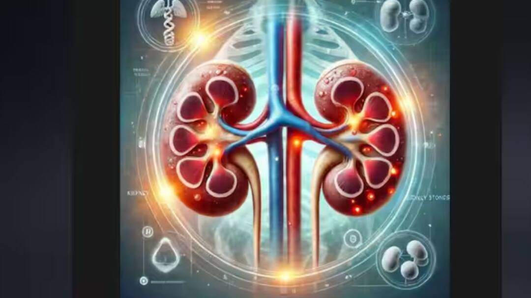 Kidney Stone: கட்டுக்கடங்காத வலி.. சிறுநீரகக் கல் பிரச்னை, சட்டென அடங்க வீட்டு வைத்தியம், நிரந்தர தீர்வு? how to get relief from kidney stone know home remedies details in tamil Kidney Stone: கட்டுக்கடங்காத வலி.. சிறுநீரகக் கல் பிரச்னை, சட்டென அடங்க வீட்டு வைத்தியம், நிரந்தர தீர்வு?