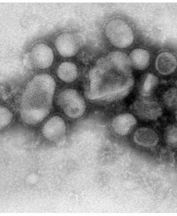 ਪੰਜਾਬ ਦੇ ਇਸ ਇਲਾਕੇ 'ਚ ਜਾਨਲੇਵਾ ਵਾਇਰਸ ਦੀ ਦਹਿਸ਼ਤ, ਲੋਕ ਰਹਿਣ ਸੁਚੇਤ...