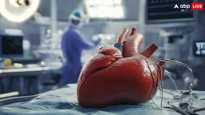 mechanical heart implanted in human for first time in india details in tamil Mechanical Heart: நாட்டிலேயே முதல்முறை..! வெற்றிகரமாக பொருத்தப்பட்ட இயந்திர இதயம், எங்கு? யாருக்கு? எப்படி வேலை செய்யும்?