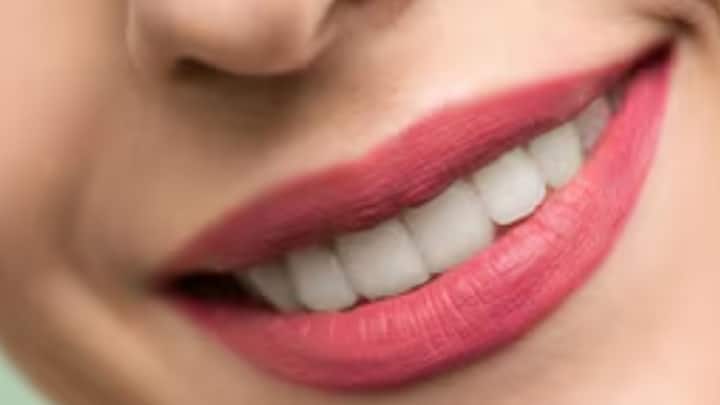 হালকা ইষৎ উষ্ণ গরম জলে সামান্য লবণ নিয়ে মুখ ধুলেও উপকার মেলে। এতে কষ্ট অনেকটাই কমে আসে।