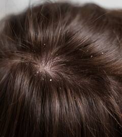 ਅਮਰੂਦ ਦੇ ਪੱਤੇ ਵਾਲਾਂ ਦੇ ਲਈ ਵਰਦਾਨ, ਵਾਲਾਂ ਦਾ ਝੜਨਾ ਅਤੇ ਡੈਂਡਰਫ ਦੀ ਸਮੱਸਿਆ ਹੁੰਦੀ ਦੂਰ, ਜਾਣੋ ਵਰਤੋਂ ਦਾ ਸਹੀ ਤਰੀਕਾ