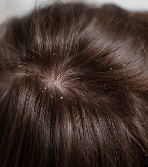 ਆਓ ਜਾਣਦੇ ਹਾਂ ਇੱਕ ਖਾਸ ਉਪਾਅ ਬਾਰੇ ਜਿਸ ਨਾਲ ਵਾਲਾਂ ਨੂੰ ਕਾਫੀ ਲਾਭ ਮਿਲਦਾ ਹੈ। ਅਤੇ ਇਹ ਇੱਕ ਸਸਤਾ ਦੇਸੀ ਨੁਸਖਾ ਹੈ। ਜੇਕਰ ਤੁਹਾਡੇ ਘਰ ਅਮਰੂਦ ਦਾ ਰੁੱਖ ਲੱਗਿਆ ਹੈ ਤਾਂ ਇਹ ਤੁਹਾਡੇ ਵਾਲਾਂ ਨੂੰ ਵੱਡਾ ਫਾਇਦਾ ਦੇ ਸਕਦਾ ਹੈ।