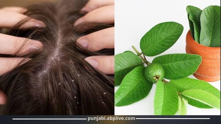 ਜਦੋਂ ਵੀ ਮੌਸਮ ਵਿੱਚ ਬਦਲਾਅ ਆਉਂਦਾ ਹੈ ਤਾਂ ਵਾਲਾਂ ਨਾਲ ਸਬੰਧਤ ਸਮੱਸਿਆਵਾਂ ਸਾਨੂੰ ਸਭ ਤੋਂ ਵੱਧ ਪਰੇਸ਼ਾਨ ਕਰਦੀਆਂ ਹਨ, ਜਿਵੇਂ ਕਿ ਵਾਲਾਂ ਦਾ ਝੜਨਾ ਅਤੇ ਡੈਂਡਰਫ। ਸਰਦੀਆਂ ਦੇ ਵਿੱਚ ਲੋਕ ਡੈਂਡਰਫ ਤੋਂ ਕਾਫੀ ਪ੍ਰੇਸ਼ਾਨ ਰਹਿੰਦੇ ਹਨ।