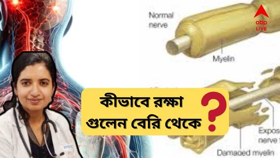 GB Syndrome: গুলেন বেরি থেকে বাঁচার কী উপায় ? কাদের ঝুঁকি সবথেকে বেশি?