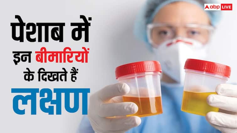 Changes in urine color smell or amount can indicate a number of health issues यूरिन में दिखने लगते हैं इस खतरनाक बीमारी के लक्षण, कहीं आप भी तो नहीं कर रहे इग्नोर?