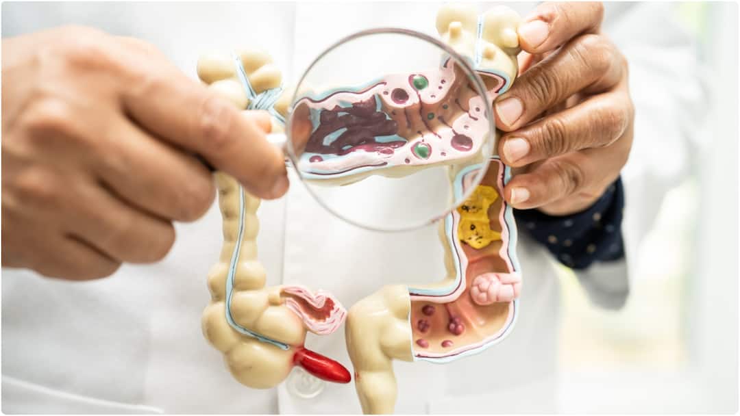 Colon Cleanse at Home : బరువు తగ్గడంతో పాటు, ఆరోగ్యానికి మేలు చేసే కోలన్ క్లెన్సింగ్.. ఇంటి చిట్కాలతో శుభ్రంగా చేసుకోండిలా Colon Cleanse Intestine How to Clean Stomach Naturally at Home Know Details Colon Cleanse at Home : బరువు తగ్గడంతో పాటు, ఆరోగ్యానికి మేలు చేసే కోలన్ క్లెన్సింగ్.. ఇంటి చిట్కాలతో శుభ్రంగా చేసుకోండిలా