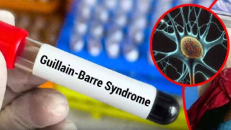 Cases of this deadly syndrome have increased in Maharashtra, be careful if you experience these symptoms GBS:મહારાષ્ટ્રમાં વધ્યાં જીવલેણ આ સિડ્રોમના કેસ, આ લક્ષણો અનુભવાય તો થઇ જજો સાવધાન