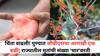 Guillain Barre Syndrome: चिंता वाढली! पुण्यात जीबीएसचा आणखी एक बळी; राज्यातील मृतांची संख्या 'चार'वरती