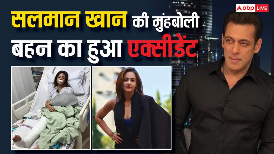 Salman Khan Adopted Sister Shweta Rohira Met an Accident share pics from hospital हाथ की टूटी हड्डी, पैर में हुआ फ्रैक्चर, सलमान खान की मुंहबोली बहन का हुआ खतरनाक एक्सीडेंट, अस्पताल से शेयर की तस्वीरें