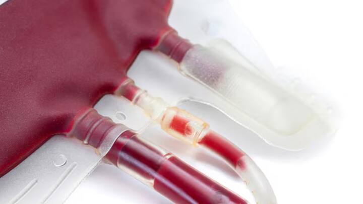 ब्रायन जॉनसन नाम का ये शख्स एंटी एजिंग है. यह करोड़पति शख्स थेरेपी के लिए अपने 17 साल के बेटे के प्लाज्मा इस्तेमाल कर रहा है.