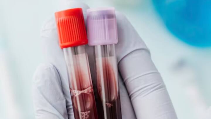 इस प्लाज्मा बैग के साथ जॉनसन ने अपने अकाउंट @bryan_johnson से शेयर किया है, जिसके बाद यूजर्स ने अपने रिएक्शन्स की बाढ़ ला दी है.