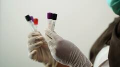 पानी के सैंपल में मिला E.Coli क्या है? जो हो सकता है ‘गुइलेन-बैरे सिंड्रोम’ की बड़ी वजह