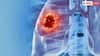 Lung Cancer: ફેફસાના કેન્સરના આ છે શરૂઆતી 3 લક્ષણો, બિલકુલ ના કરો નજરઅંદાજ