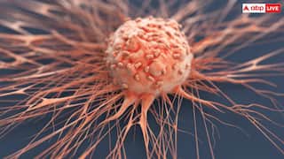 World Cancer Day: कैंसर से बचने के ये हैं पांच सबसे कारगर तरीके, जानें कैसे होता है बचाव