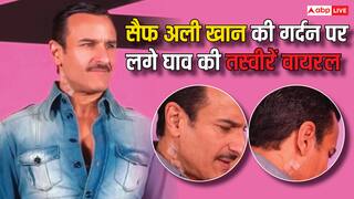 हमले के बाद काम पर लौटे सैफ अली खान, एक्टर की  गर्दन पर दिखे चोट के निशान, तस्वीरें हो रहीं वायरल