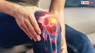 शरीर में होने वाली इस तरह की सूजन को बिल्कुल भी न करें नजरअंदाज, हो सकते हैं गंभीर बीमारी के लक्षण