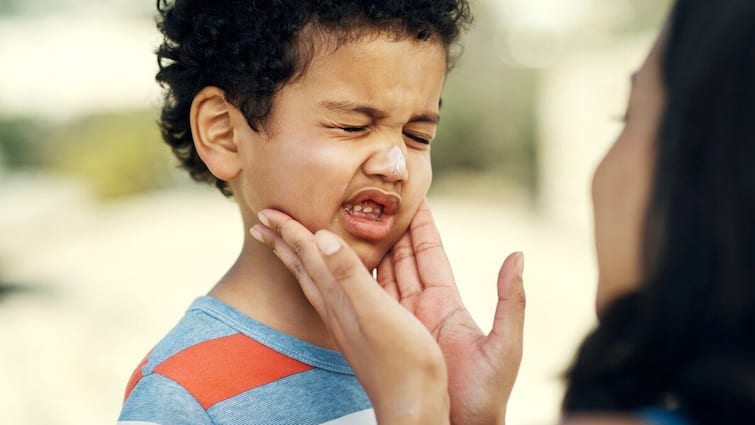 mumps aka ponnukku veengi case on rise know the reason treatment prevention tips in tamil Mumps Warning: குழந்தைகள் ஜாக்கிரதை - வேகமாக பரவும் பொன்னுக்கு வீங்கி - நோய்க்கான காரணம், அறிகுறிகள், சிகிச்சை, தடுப்பது எப்படி?