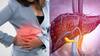 Liver Disease: લીવર ફેઈલ થવા પર તમારા શરીરમાં જોવા મળે છે આ લક્ષણો, સમયસર કરો સારવાર