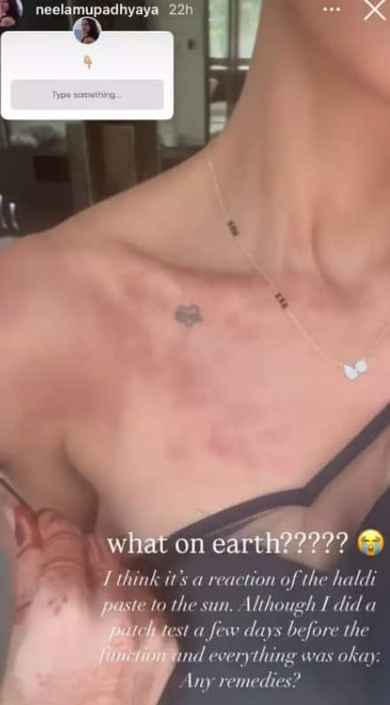 Priyanka Chopra की भाभी को शादी के 3 दिन बाद ही हुई ये परेशानी, सोशल मीडिया पर आकर किया खुलासा