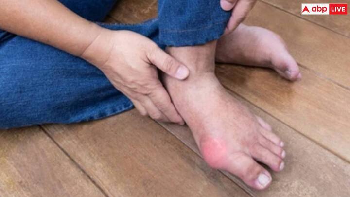 जिन लोगों का यूरिक एसिड लेवल हाई है, वे तेजपत्ते की चाय या काढ़ा पी सकते हैं। इसे बनाने के लिए 10-20 तेजपत्ते लें. एक बर्तन में तीन गिलास पानी लें और उसमें तेजपत्ते डालें. बर्तन को गैस पर रखें और तब तक पकाएं जब तक कि सिर्फ एक गिलास पानी न रह जाए। इस पानी को गुनगुना करके दिन में दो बार पिएं। तेजपत्ते की चाय पीने से आपका यूरिक एसिड कंट्रोल में रहेगा.