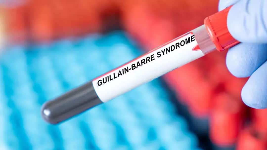 Second victim of GBS syndrome in Kolhapur Five people undergoing treatment in CPR कोल्हापुरात जीबीएस सिंड्रोम आजाराचा दुसरा बळी; सीपीआरमध्ये पाच जणांवर उपचार सुरु