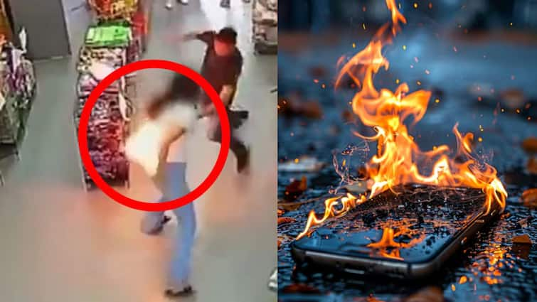 smartphone bursts into flames in pocket women faced burn injury watch video