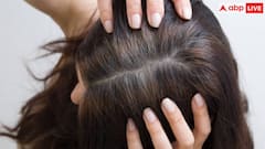 कम उम्र में ही बाल सफेद होने की क्या है वजह, किन लोगों को जल्दी होती है यह दिक्कत?