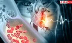 ਦਿਲ ਦੀਆਂ ਨਸਾਂ ਹੋ ਰਹੀਆਂ ਬਲਾਕ ਤਾਂ ਸਰੀਰ ‘ਚ ਨਜ਼ਰ ਆਉਂਦੇ ਆਹ ਲੱਛਣ, ਭੁੱਲ ਕੇ ਵੀ ਨਾ ਕਰੋ ਇਗਨੋਰ