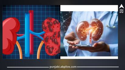 ਗੁਰਦੇ ਸਾਡੇ ਸਰੀਰ ਦੇ ਮਹੱਤਵਪੂਰਨ ਅੰਗਾਂ ਚੋਂ ਇੱਕ ਹੈ, ਜੋ ਸਰੀਰ ਚ ਕਈ ਮਹੱਤਵਪੂਰਨ ਕਾਰਜ ਕਰਦਾ ਹੈ।ਗੁਰਦਿਆਂ ਦੇ ਬਹੁਤ ਸਾਰੇ ਕੰਮ ਹੁੰਦੇ ਹਨ, ਜਿਨ੍ਹਾਂ ਵਿੱਚੋਂ ਮੁੱਖ ਕੰਮ ਖੂਨ ਦੀ ਸਫਾਈ ਕਰਨਾ, ਸਰੀਰ ਵਿੱਚੋਂ ਜ਼ਹਿਰੀਲੇ ਪਦਾਰਥਾਂ ਨੂੰ ਕੱਢਣਾ